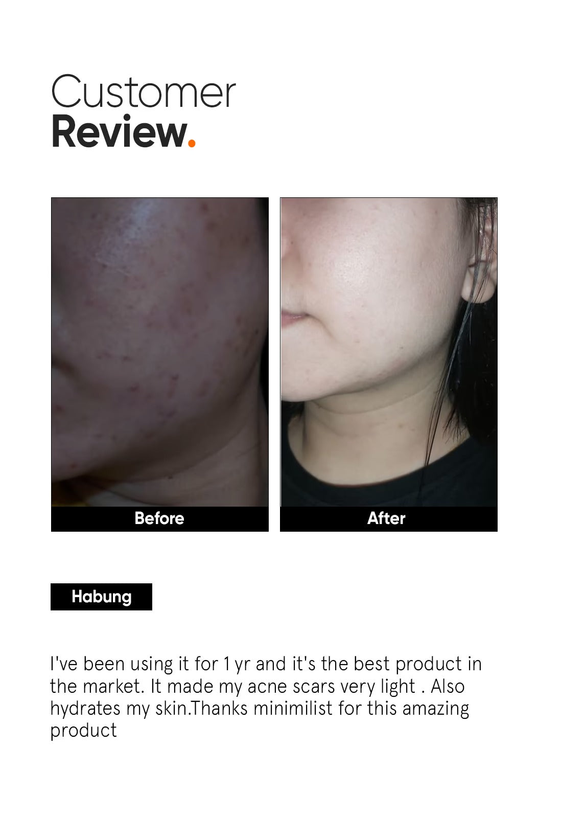 Minimalist Alpha Arbutin 2% Face Serum - 5