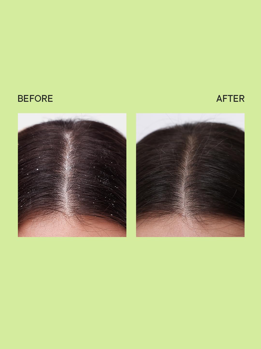 Quench Dandruff Control Scalp Scrub - 200ml - 5