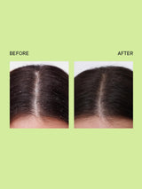 Quench Dandruff Control Scalp Scrub - 200ml - 5
