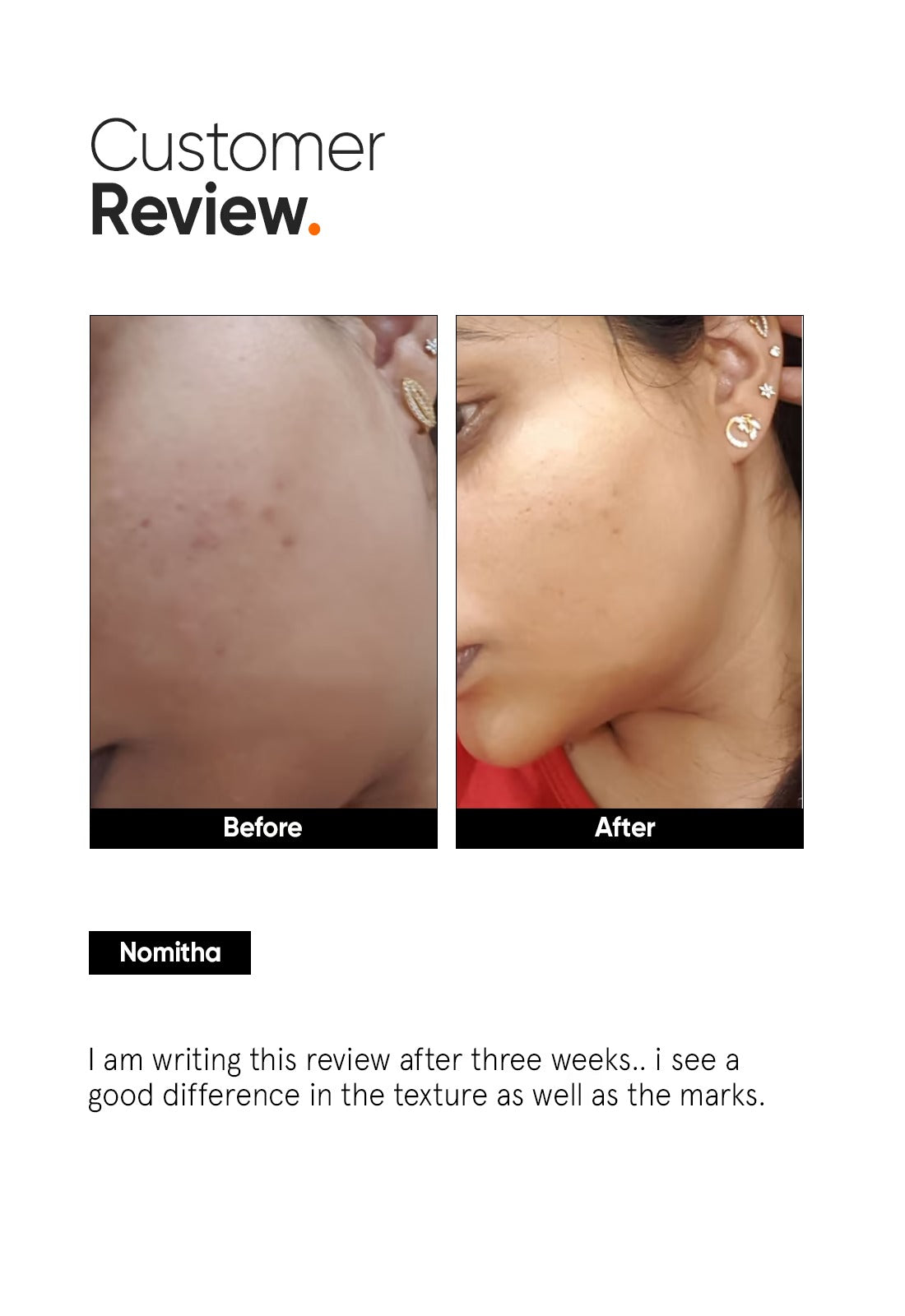Minimalist AHA PHA BHA 32% Face Peel - 5