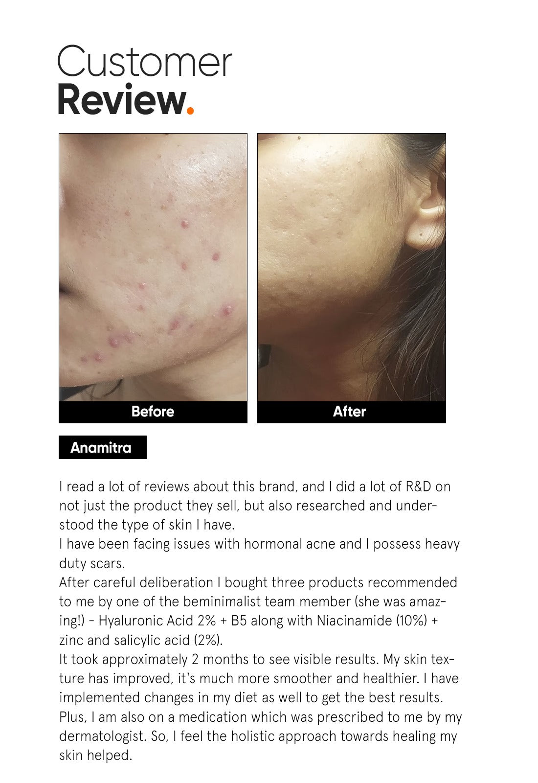 Minimalist Hyaluronic + PGA 2% Face Serum - 5