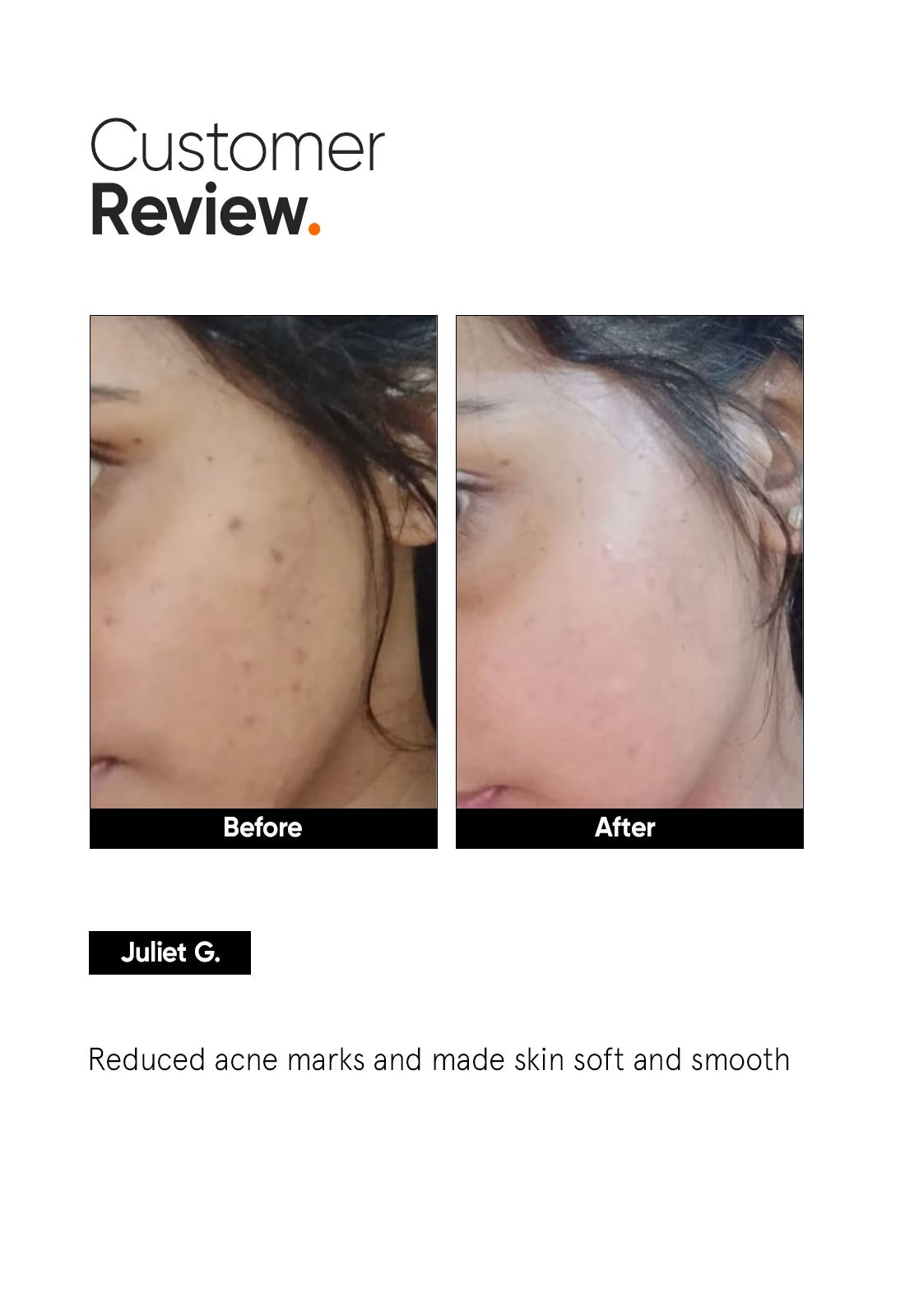 Minimalist Niacinamide 5% Face Serum - 6