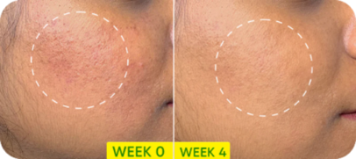 Dot & Key Cica (Centella) + Niacinamide Oil Free Moisturizer - 11