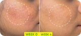 Dot & Key Cica (Centella) + Niacinamide Oil Free Moisturizer - 11